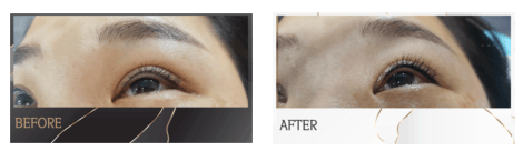 아이라인 반영구