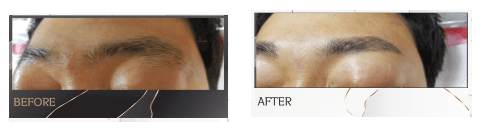 남자 눈썹문신 산본 군포4