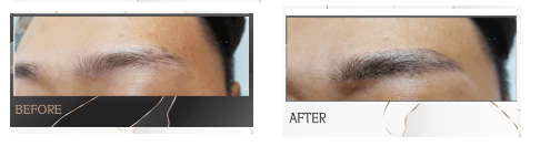 남자 눈썹문신 산본 군포5