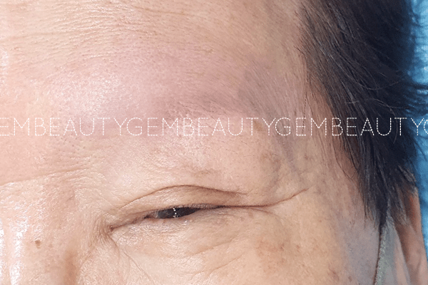 부평 부천 눈썹반영구1