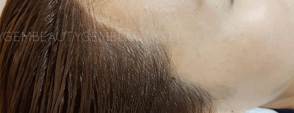 부평 헤어라인 반영구 잘하는 곳 - 복사